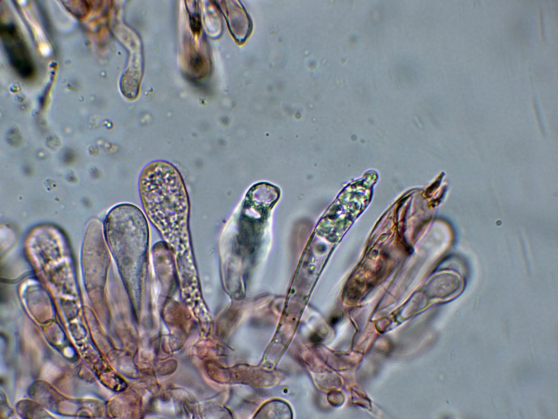 Microscopía de Russula fragrantissima - 10 - Cistidios-001